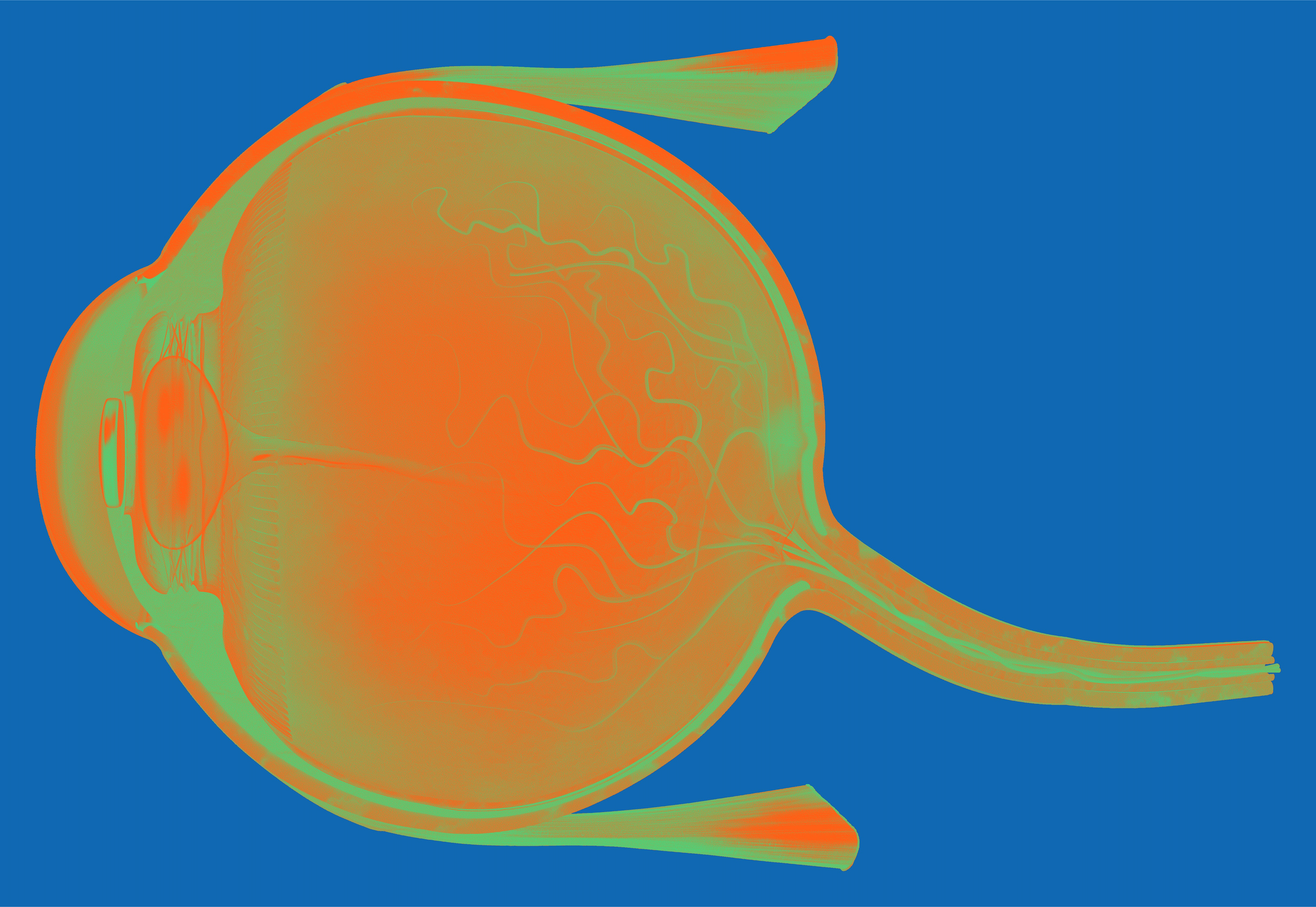 Opthalmology