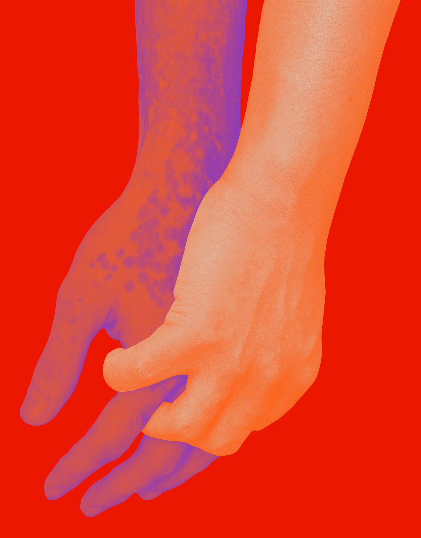 JJ Bodyillustration Exterior Claspedhandsvitiligo Colorway01