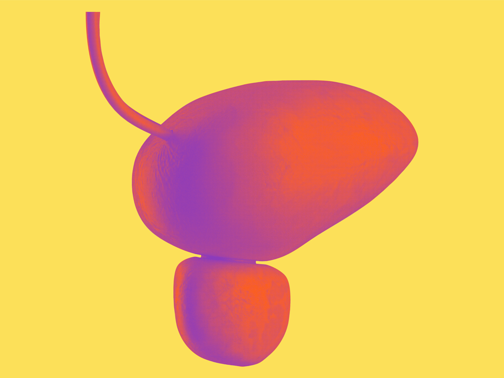 Bladder Cancer