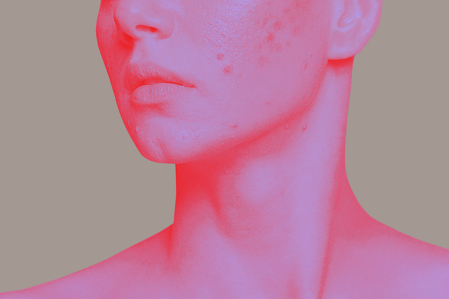 Illustration of textured skin on female lower face.