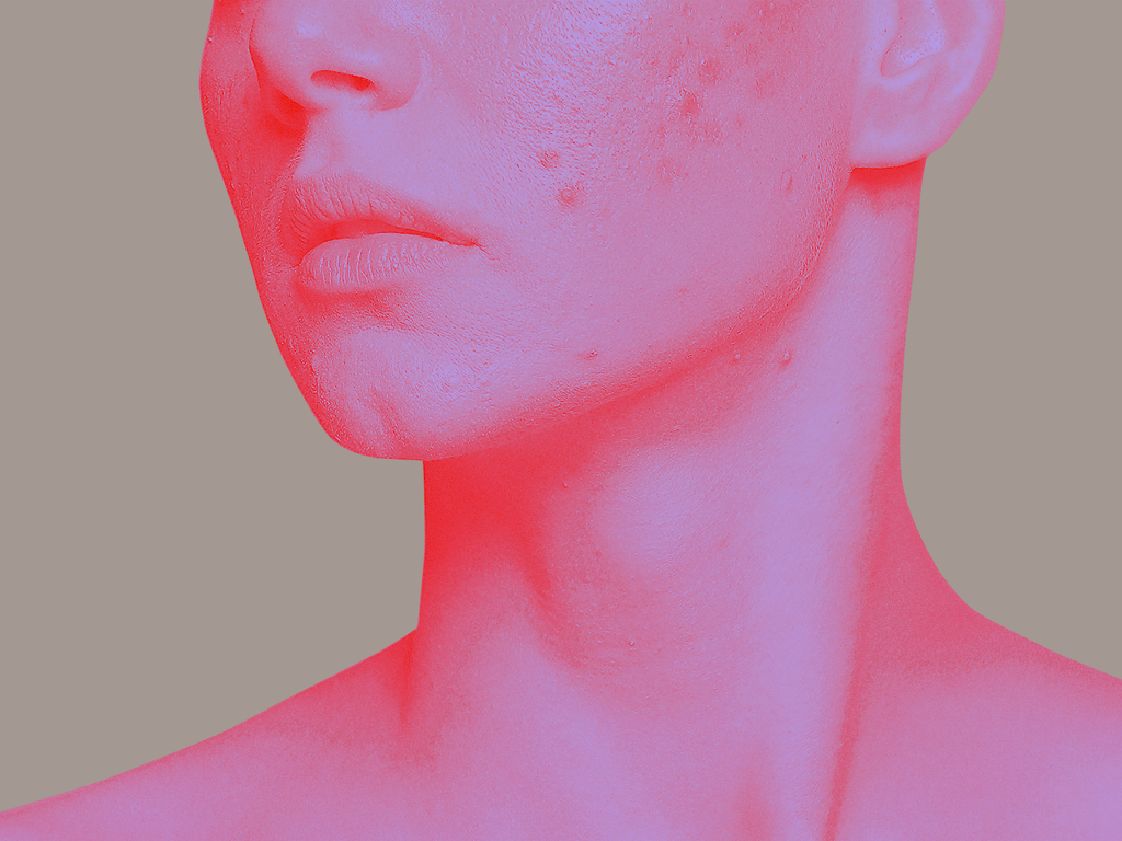 Immunodermatology