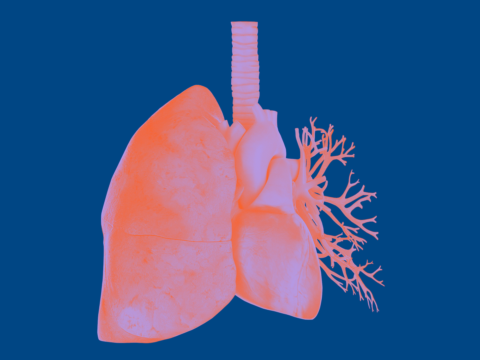 Lung Cancer