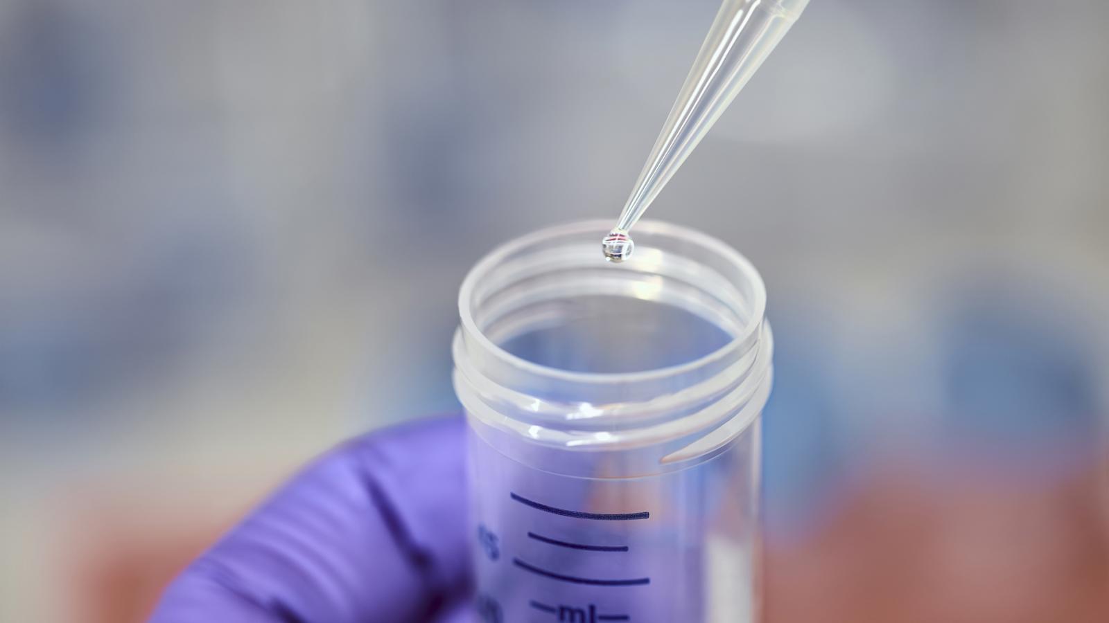 Hands holding a beaker and pipette adding liquid drops to the beaker